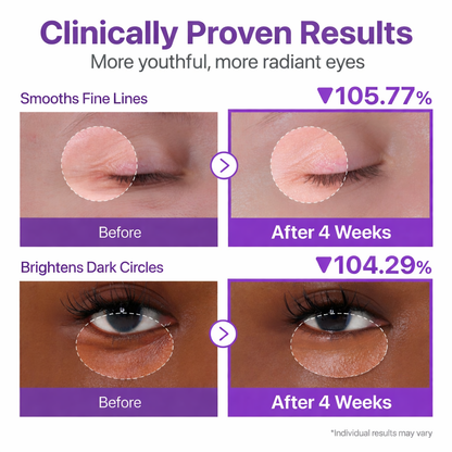 No.9 NAD+ Retinol Volumetox Eye Cream
